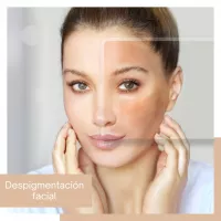 Despigmentacion Facial